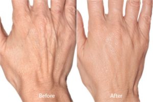 Rancho Cucamonga Skin & Hand Rejuvenation